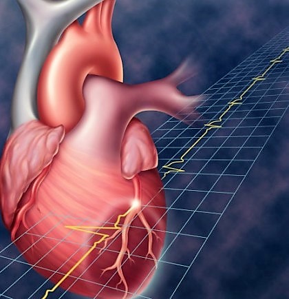 Инфаркт передней стенки сердца последствия